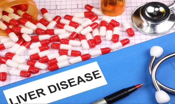 Health Tips: Fatty Liver का Silent Attack, Grade 1 को ‘Normal’ समझने की भूल पड़ सकती है बहुत भारी